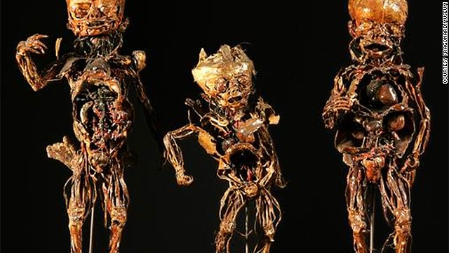 10 viện bảo t&agrave;ng y học kỳ dị nhất tr&ecirc;n thế giới